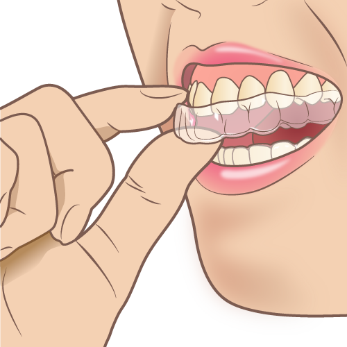 診療について ひびの歯科